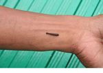 Forest leech on man's wrist (Kalimantan, Borneo (Indonesian Borneo)) 